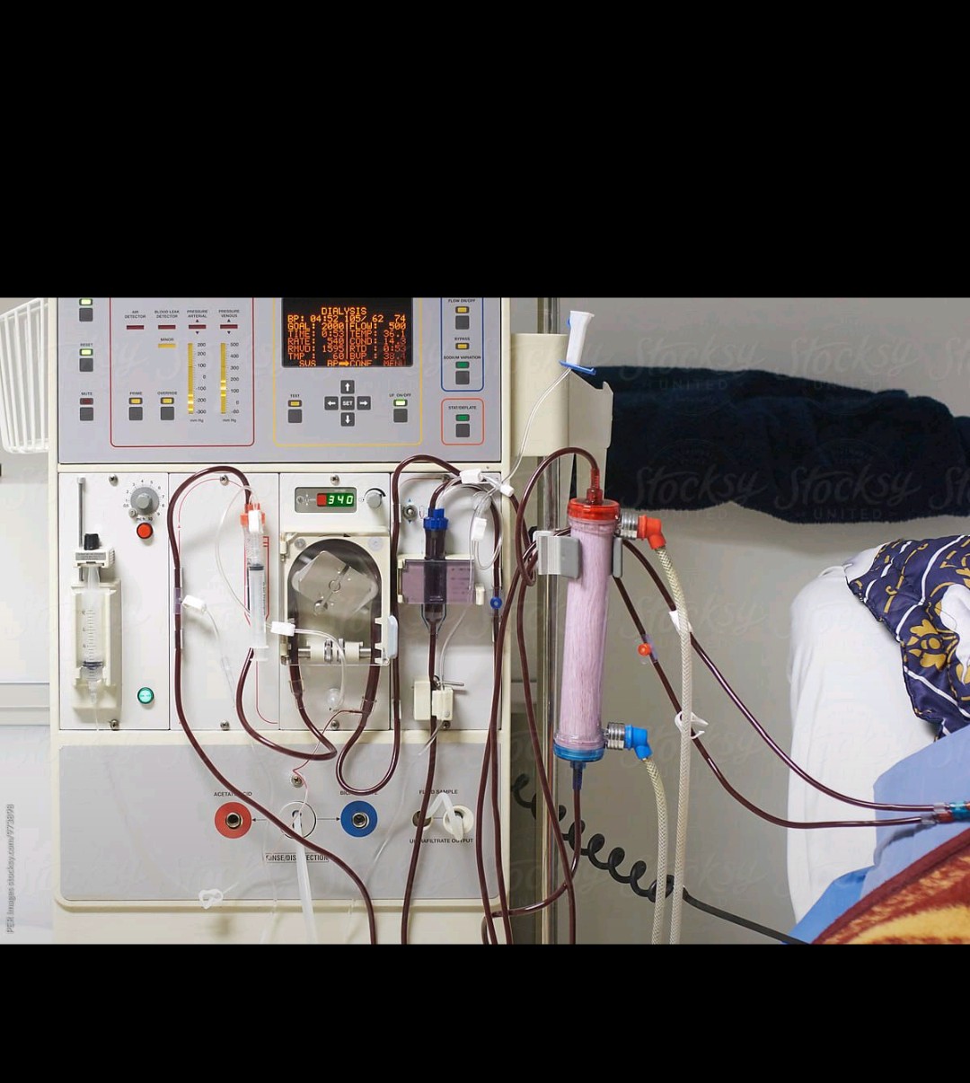 fresenius 2008 series general troubleshooting